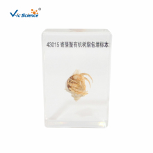 Embedded Specimen of Hermit Crab