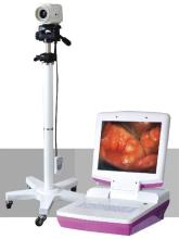 Genes & Life Science Equipments Type video colposcope for vagina