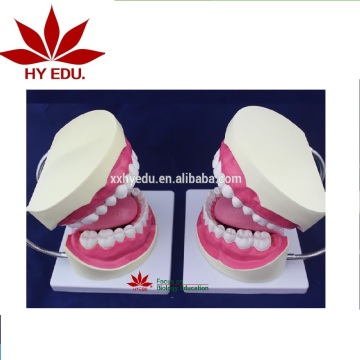 6X Life Size Oral Teeth Hygiene Model - Dental Teaching Model with Brush