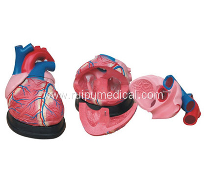 Medical Jumbo Heart Model