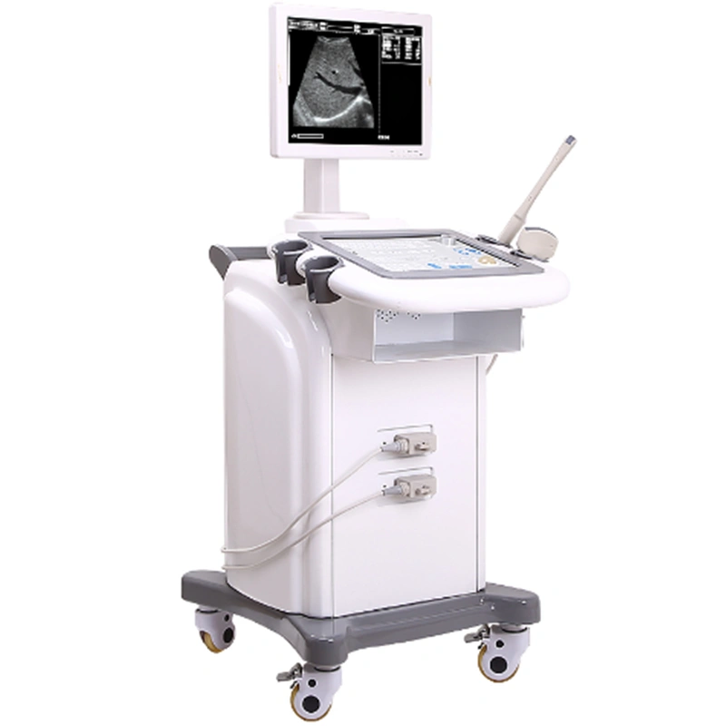 portable Black/White Trolley Ultrasound Scanner