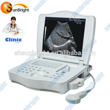 digital portable LCD ultrasound