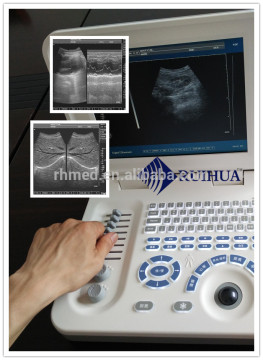 Best China Ultrasound Scanner Echo Machine /echography