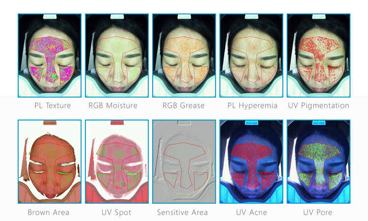 Skin Diagnostic Analyzer Skin Diagnostic Analyzer
