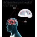 Infrared Physiotherapy Helmet For Brain Tumor Rehabilitation