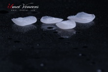 Biocompatible Whitening Zirconia Veneers