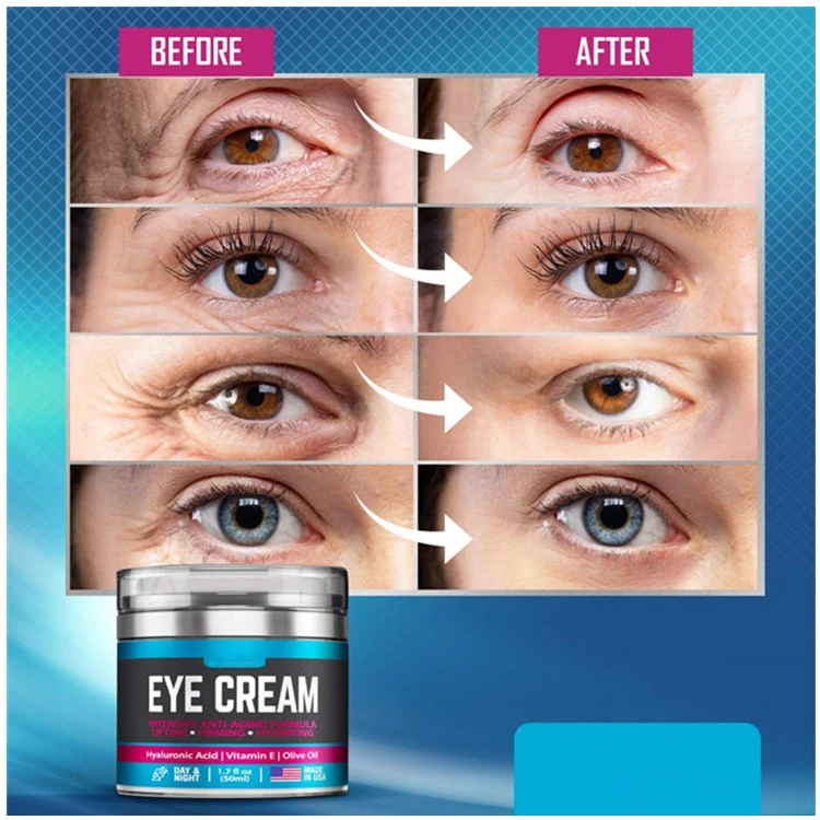 Collagen Best Skin Anti Aging Wrinkles Organic Private Label Eye Cream for Women