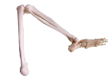 Lower limb bone