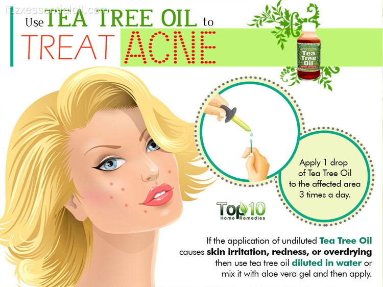 Olio di tea tree in Australia per il trattamento dell&#39;acne