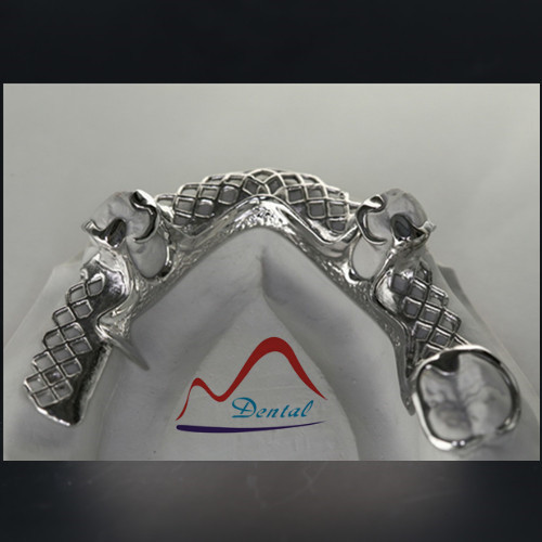 Vitallium framework  (3)