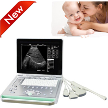 Animal Notebook Ultrasound/15inch Ultrasonic Scanner/Echo sonography