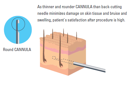 Blunt cannula