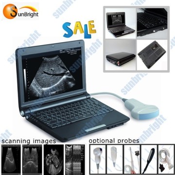 Mini Laptop Ultrasound Machine For Home use