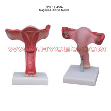 Magnified Uterus Model-J3C4.19.436A