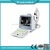 Digital Laptop Ultrasonic Diagnosis ophthalmic Equipment for Human