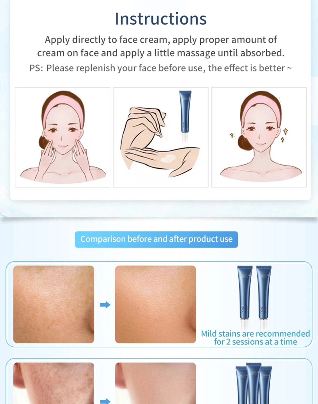 Hot Sale Whitening Cream Freckle Treatment Cream