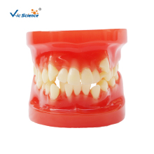 Medical Dental Orthodontic Model With Bracket
