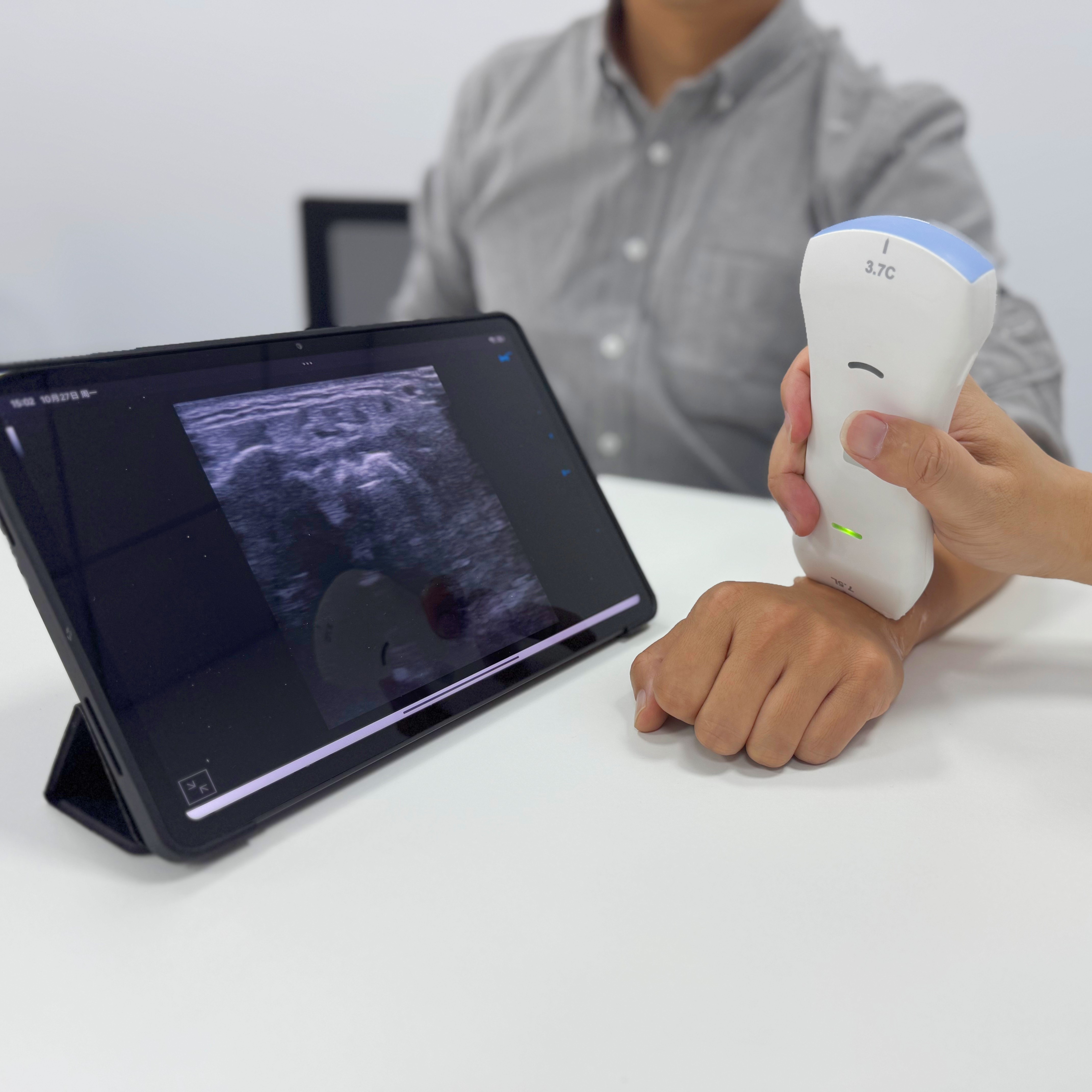 портативный аппарат УЗИ portable ultrasound machine