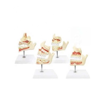 DARHMMY 4-Stage Dental Development Model for Medical Teaching