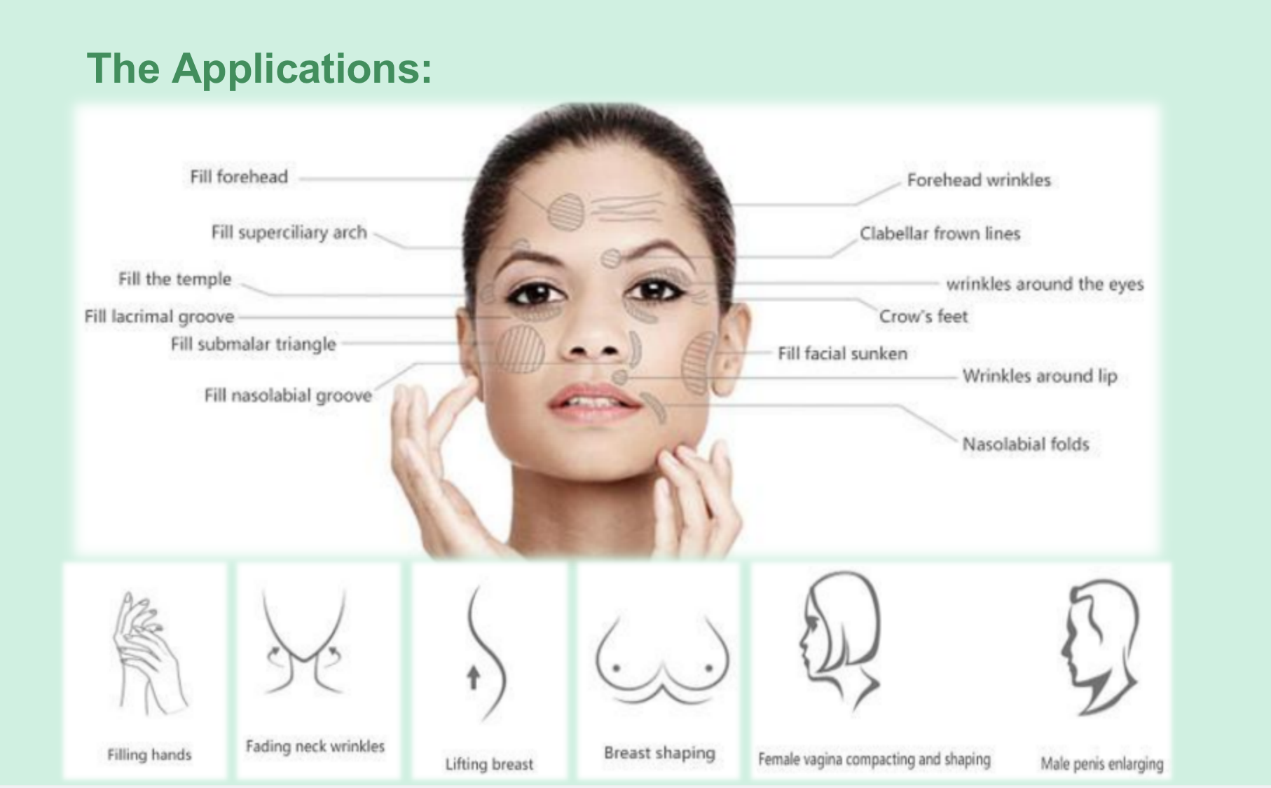 The applications of Reborn PLLA Dermal Fillers