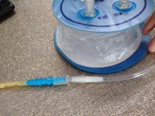 Negative pressure drainage reservoir surgical drainage