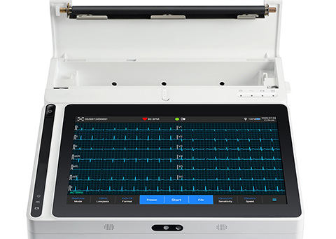 Moniteur du patient