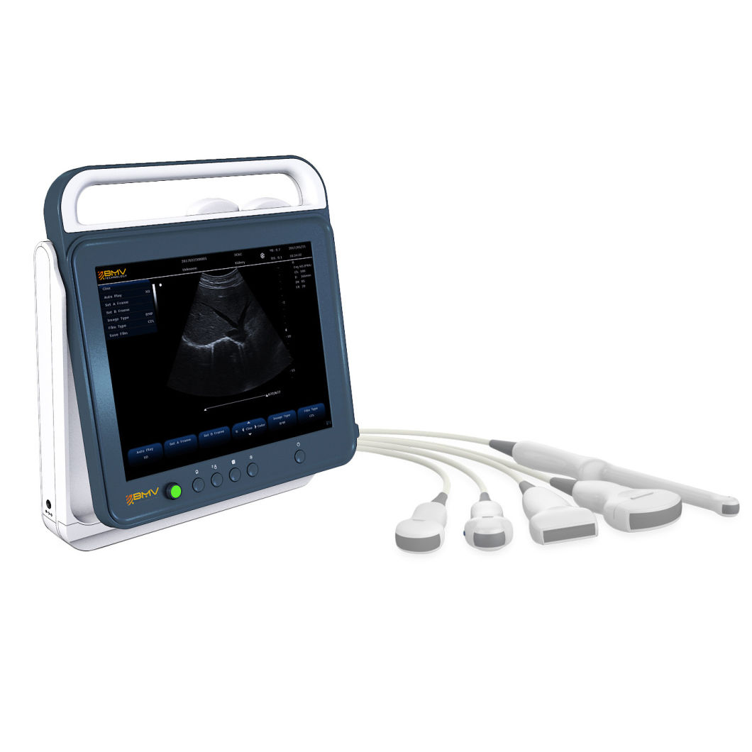 PT50A Portable Ultrasound Machine Veterinary Equipment