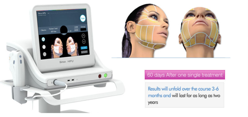 High Intensity Focused Ultrasound Machine Treatment Wrinkle Skin Rejuvenation Hifu
