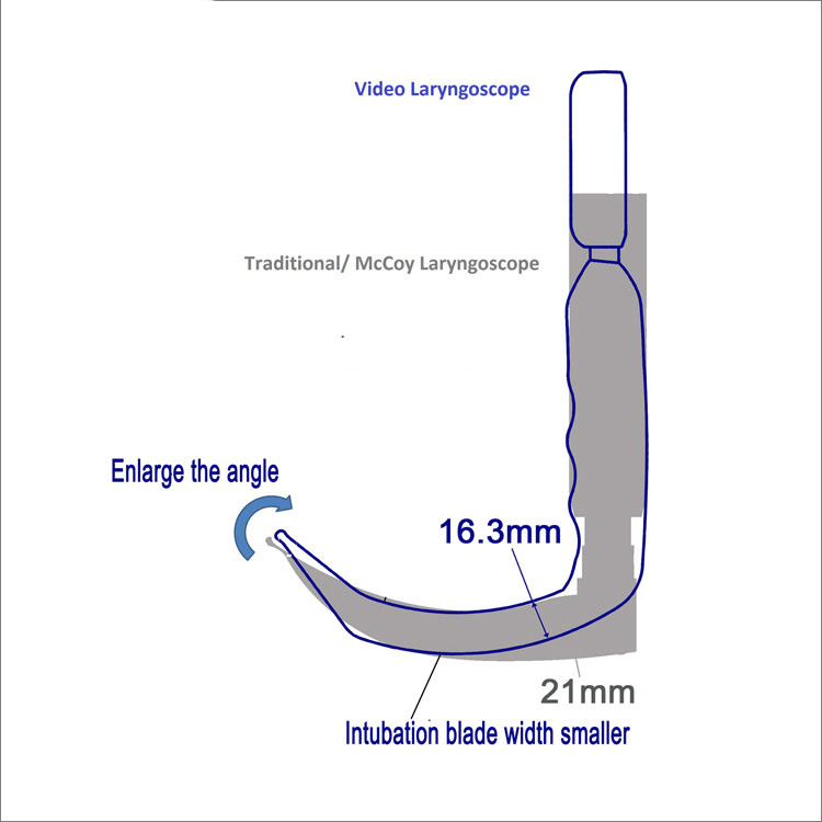 Ce Laringoscopio Video Laringoskop