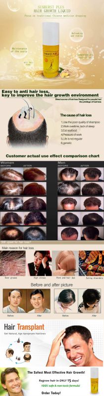 Sunburst Plus Hair Growth Lotion, Fast Hair Growth Products, Original Hair Repair Nourishing Liquid for Hair Loss 100ml
