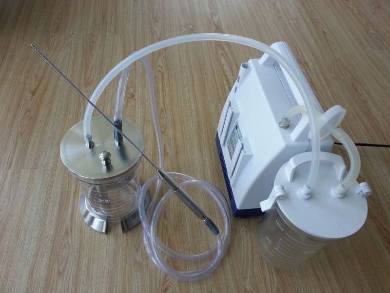 Injectable Fat for Autologous Fat Transfer Filter