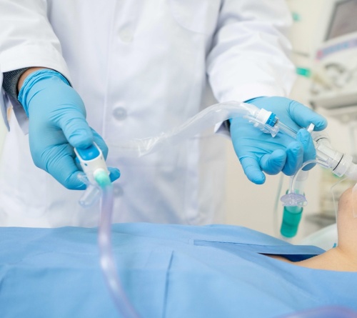 What are the differences between 24 hours & 72 hours closed suction catheters