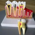 Factory Direct Dental Pulp Disease Model: Exploring Two Key Aspects of Medical Science1