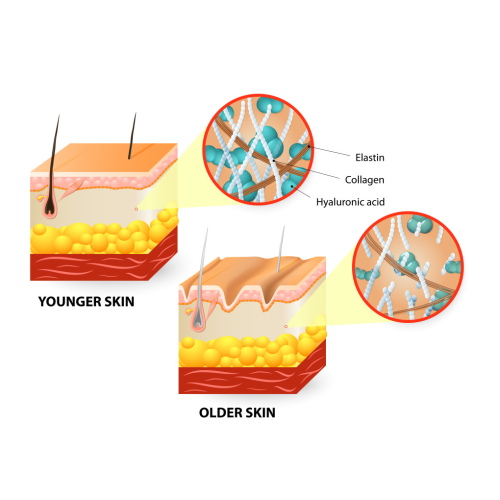 Why we're loving RF Skin Tightening | Choicy Beauty- a beauty training academic    