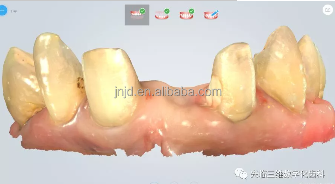 High quality 3d  intraoral scanners with high accuracy and light weight are suitable for dental clinics
