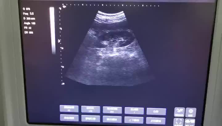 Video Ultrasound Laptop 3