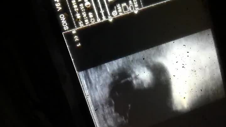 Wired Equine Ultrasound