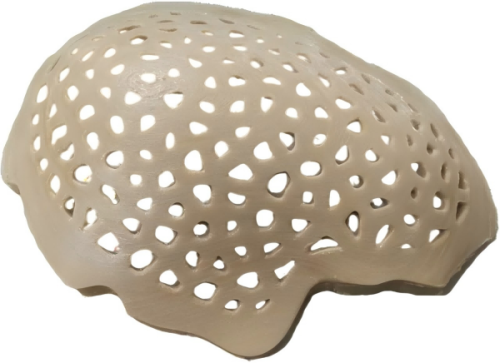 3D -gedruckte Peek -Materialien im medizinischen Bereich
