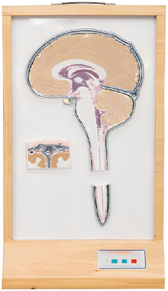 Electric model of cerebrospinal fluid circulation
