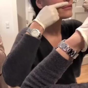 Ha filler  6