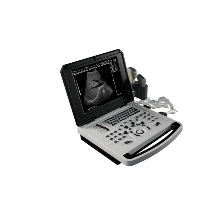 MDK-830 Notebook B-ultrasound Scanner Introduction