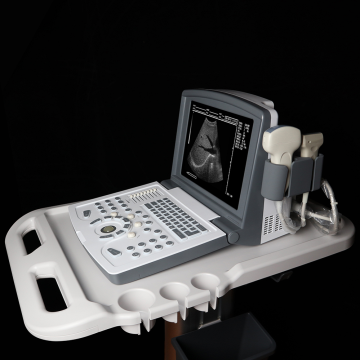 List of Top 10 Black And White Ultrasound Scanner Brands Popular in European and American Countries