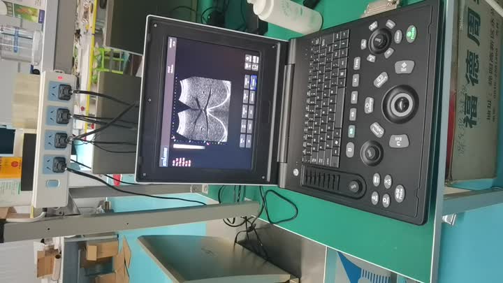 Video Ultrasound Laptop 6