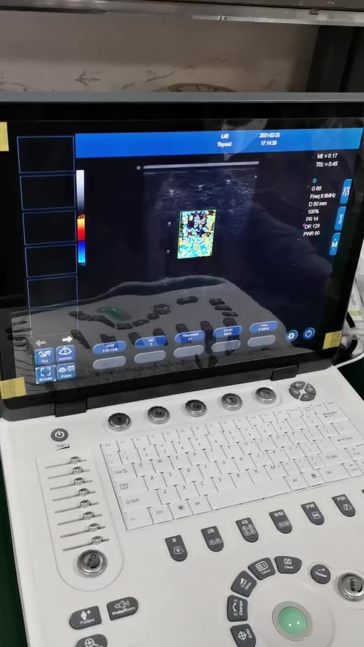 Sistema de ultrassom de Doppler colorido C5Pre
