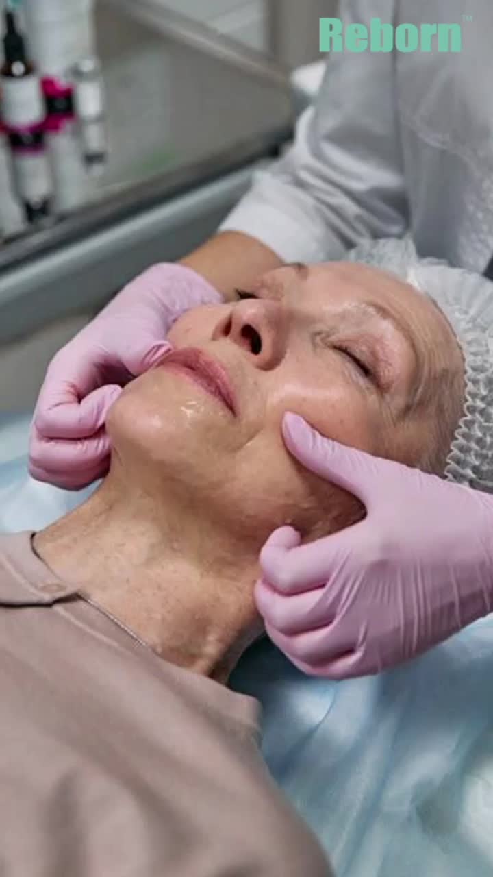 PLLA Dermeur Filler pour le soulèvement du visage