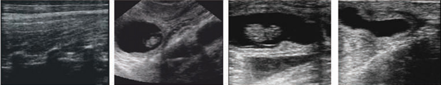 pet ultrasound