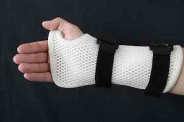 Splint Wrist