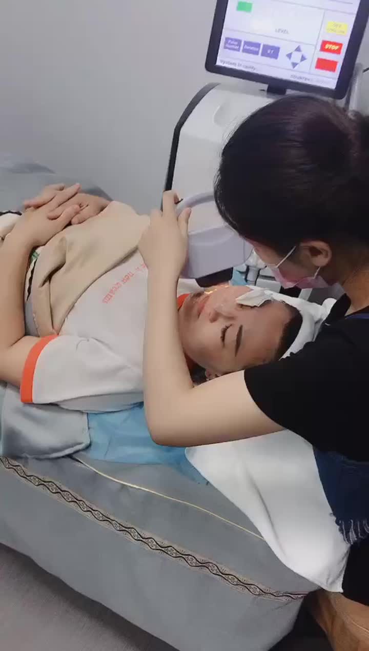 IPL treatment