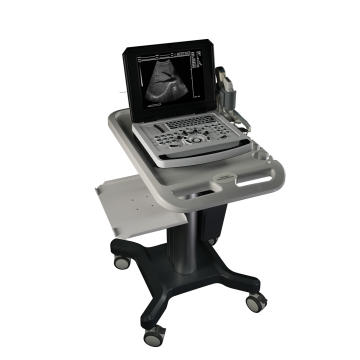 Ten Chinese Laptop Ultrasound Machine Suppliers Popular in European and American Countries