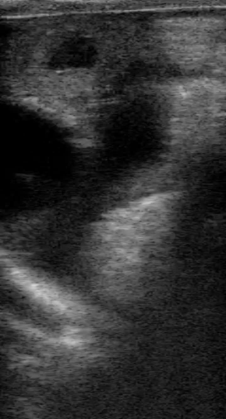 portable ultrasound machine for cows